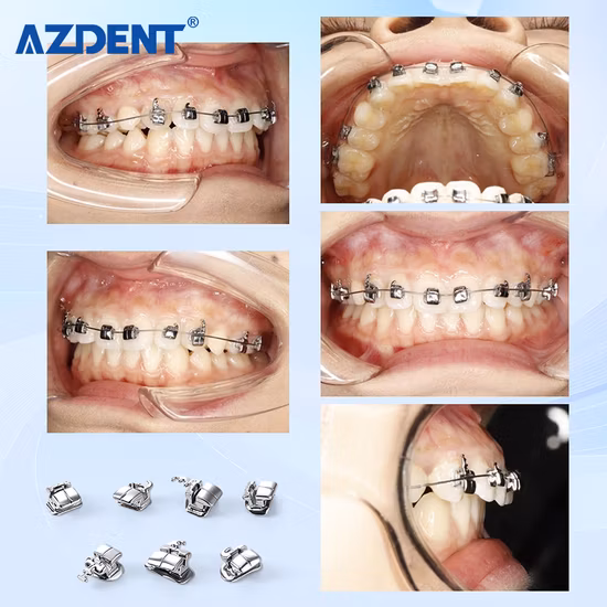 Dental Equipments Chinese Best Selling Orthodontic Teeth Braces Odontology Roth/Slide Self Ligating Brackets